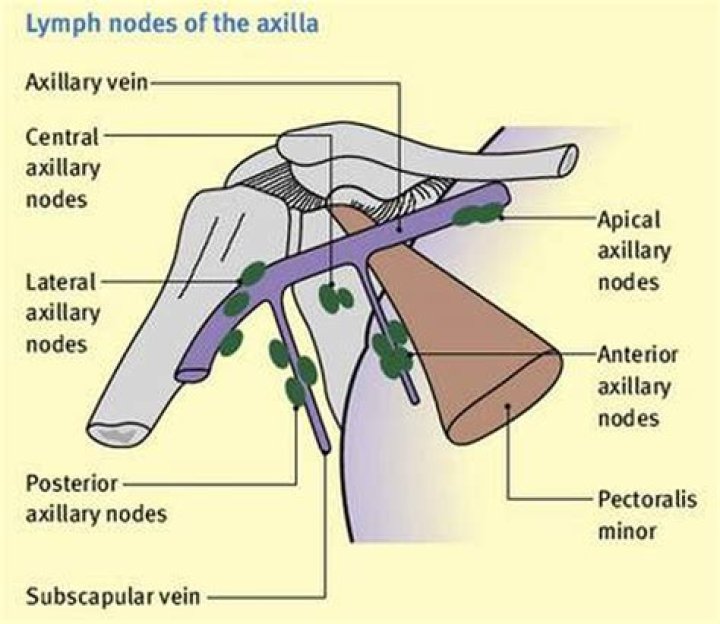 How many lymph nodes are in axillary dissection