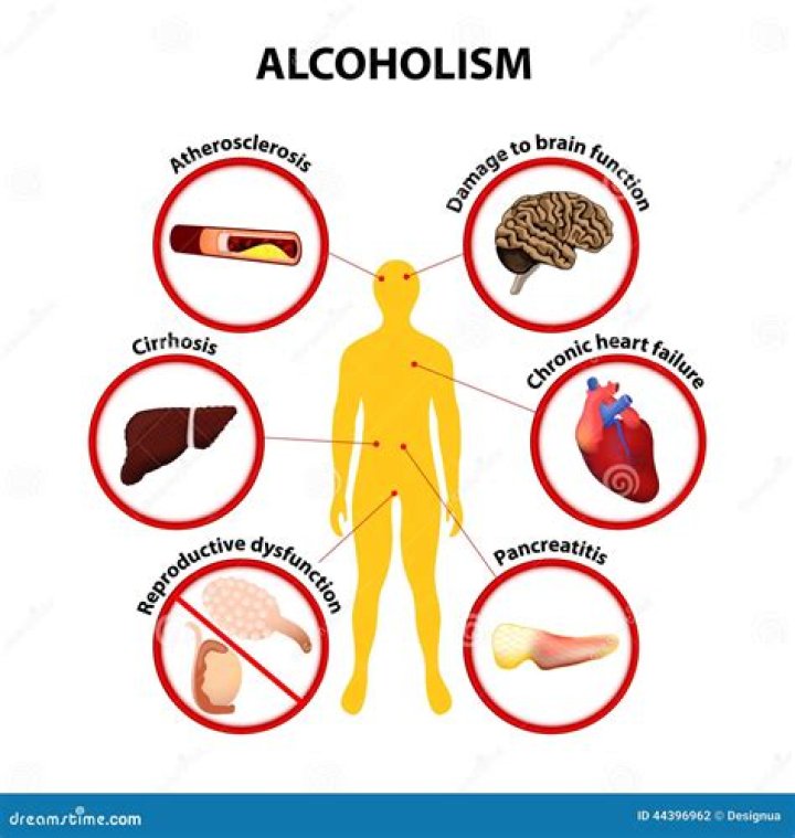 Is alcoholism a medical term