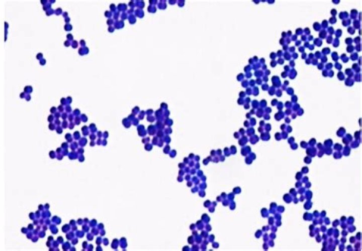 Is Staphylococcus gram positive or negative