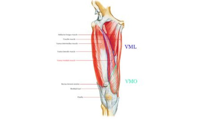 What is VMO muscle